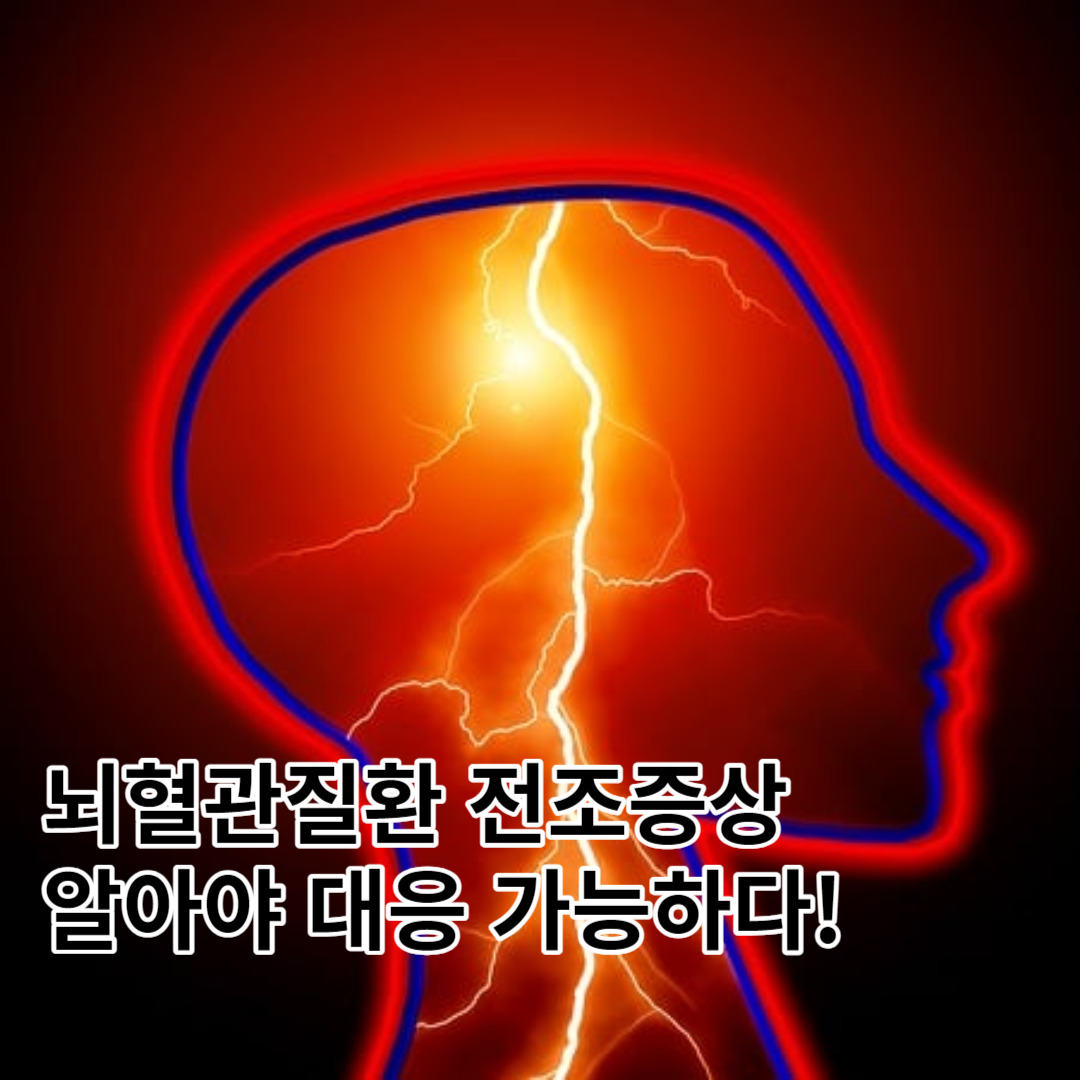 뇌혈관질환 전조증상, 1주일 내 약 80% 발생 예방 및 관리 방법