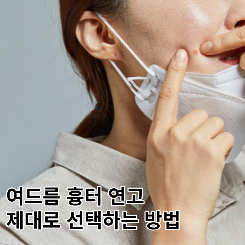 여드름 흉터 연고, 잘못된 종류의 연고를 쓰고 있는건 아닐까?