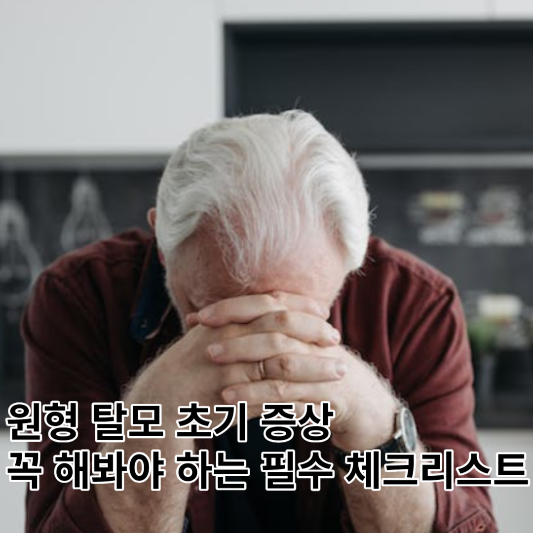 원형 탈모 초기, 두피가 가렵고 머리가 빠진다면 꼭 해봐야 하는 필수 체크리스트.