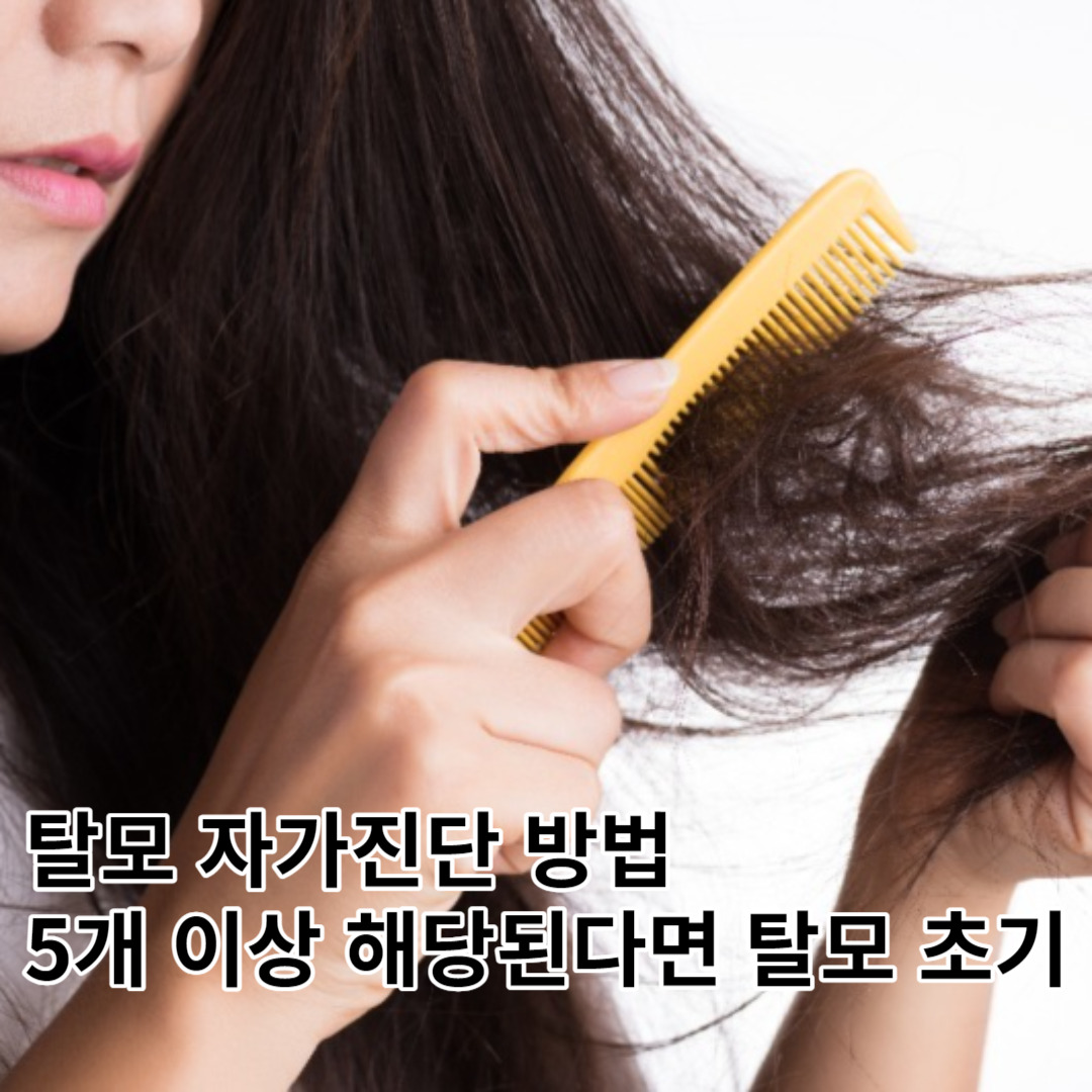 탈모 자가진단, 5개 이상 해당된다면 탈모 의심. 조기 치료가 중요해.