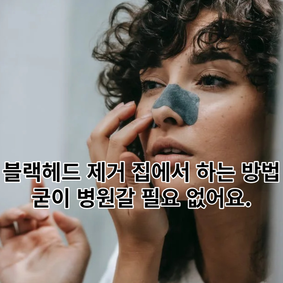 블랙헤드 제거 집에서 하는 방법, 굳이 병원갈 필요 없어요.