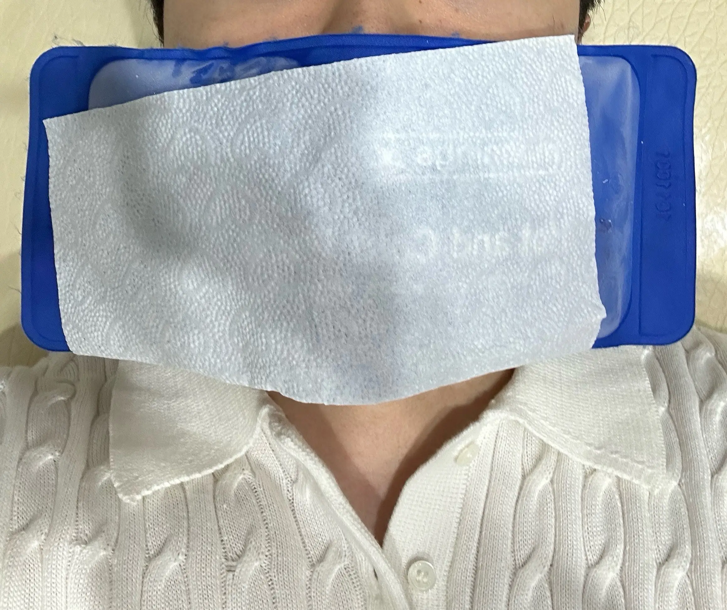 수염 레이저 제모